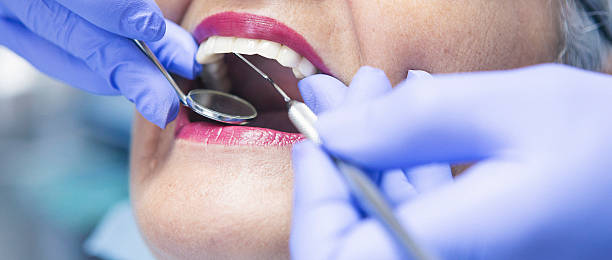 Best Emergency Dental Care for Abscessed Tooth in Van Alstyne, TX